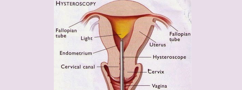 Gynecologist & IVF Specialist